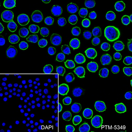 Anti-CD99 Rabbit mAb