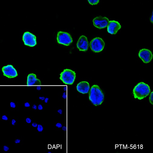 Anti-Cystatin A Rabbit mAb