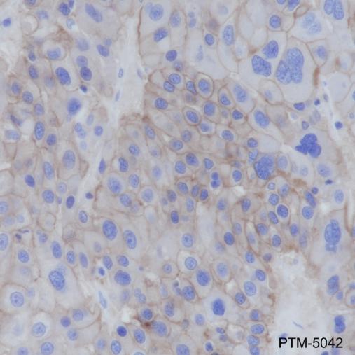 Anti-EGFR Rabbit mAb