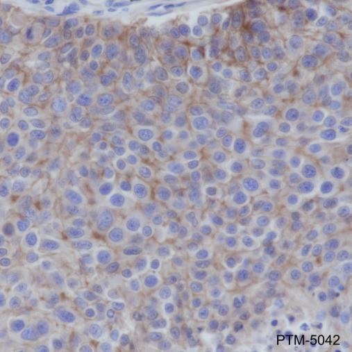 Anti-EGFR Rabbit mAb