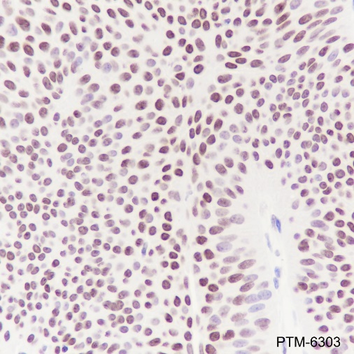 Anti-HMGA1 Rabbit mAb