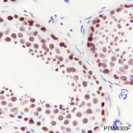 Anti-HMGA1 Rabbit mAb