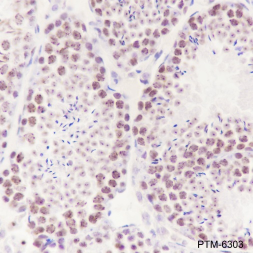 Anti-HMGA1 Rabbit mAb