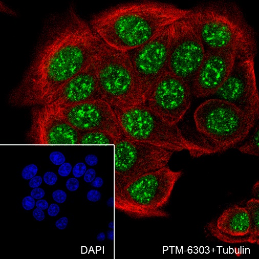Anti-HMGA1 Rabbit mAb