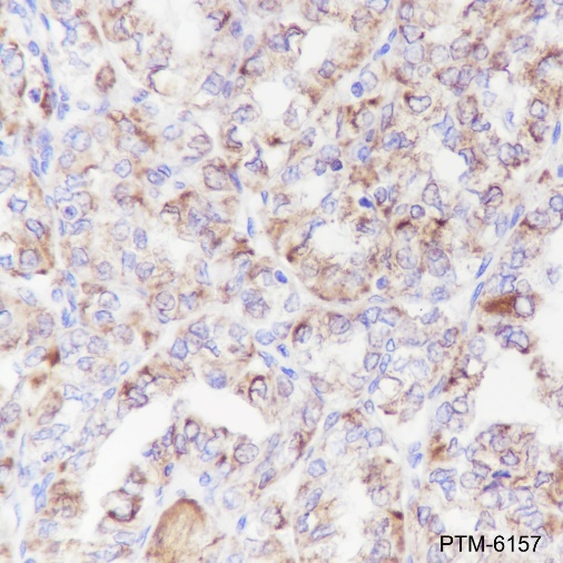 Anti-VDAC1/Porin Rabbit mAb