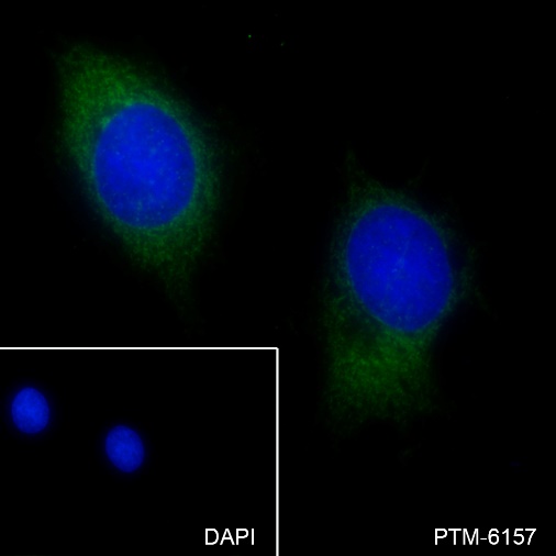 Anti-VDAC1/Porin Rabbit mAb