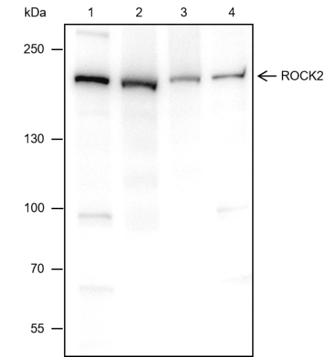 Anti-ROCK2 Rabbit mAb