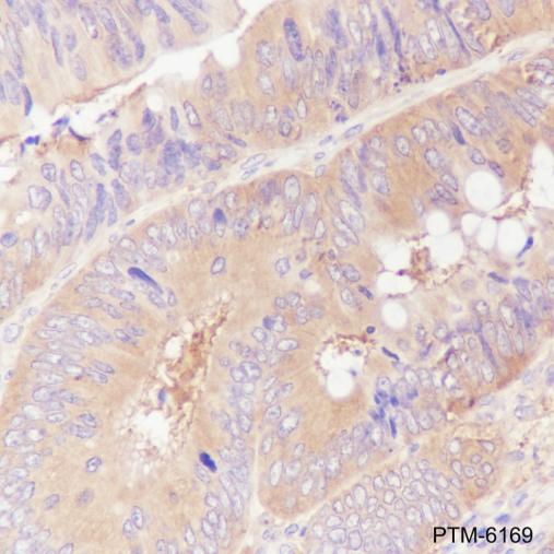 Anti-ROCK2 Rabbit mAb