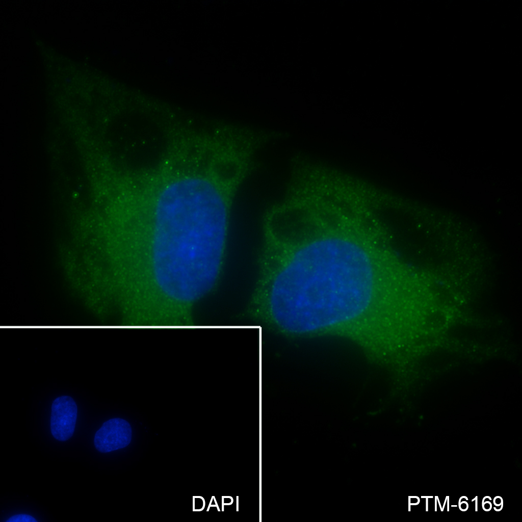 Anti-ROCK2 Rabbit mAb