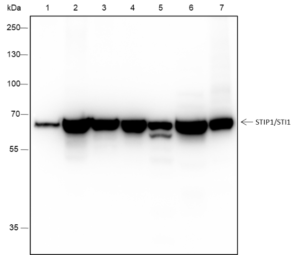 Anti-STIP1/STI1 Rabbit mAb