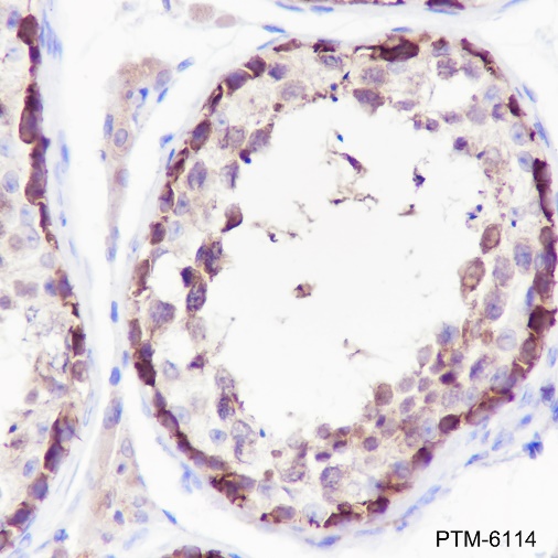 Anti-STIP1/STI1 Rabbit mAb