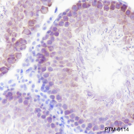 Anti-STIP1/STI1 Rabbit mAb