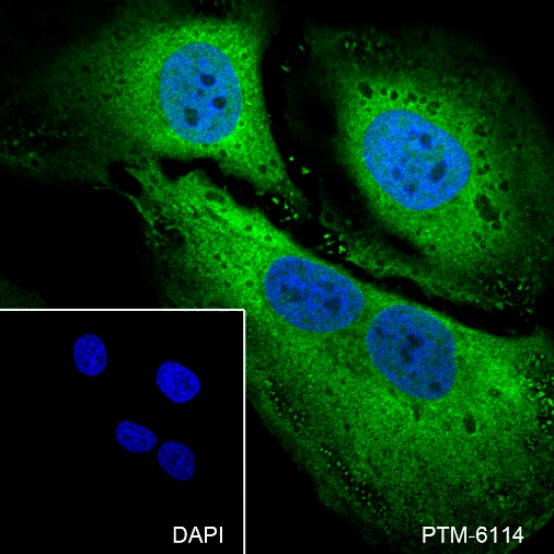 Anti-STIP1/STI1 Rabbit mAb