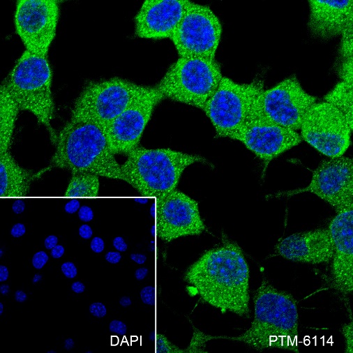 Anti-STIP1/STI1 Rabbit mAb