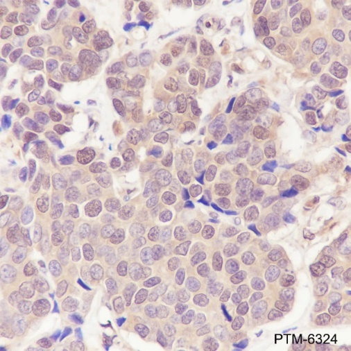Anti-p44/42 MAPK (Erk1/2) Rabbit mAb