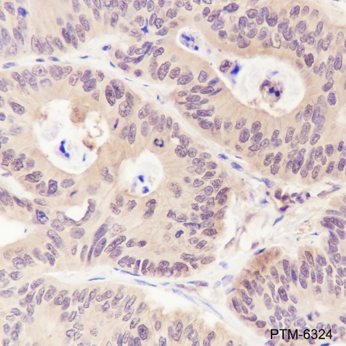 Anti-p44/42 MAPK (Erk1/2) Rabbit mAb