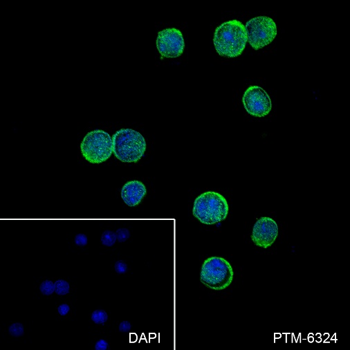Anti-p44/42 MAPK (Erk1/2) Rabbit mAb