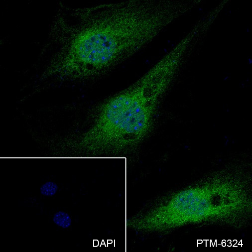 Anti-p44/42 MAPK (Erk1/2) Rabbit mAb