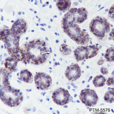 Anti-TROP2 Rabbit mAb