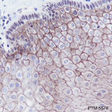 Anti-TROP2 Rabbit mAb