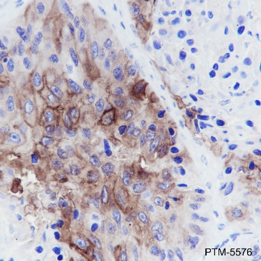 Anti-TROP2 Rabbit mAb