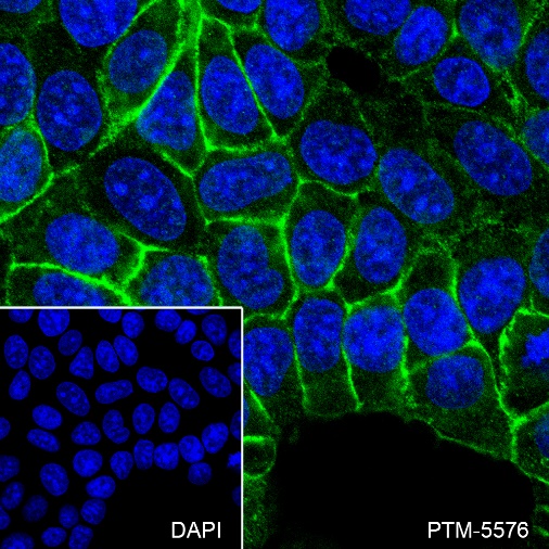 Anti-TROP2 Rabbit mAb
