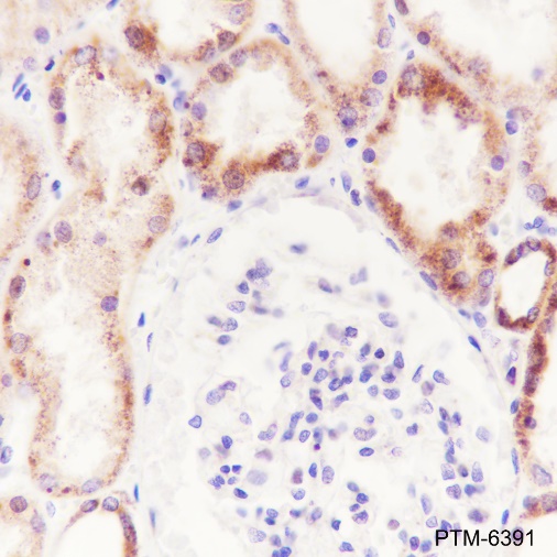 Anti-GSTK1 Rabbit mAb