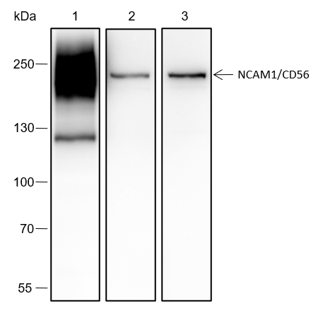 Anti-NCAM1/CD56 Rabbit mAb