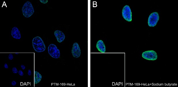 Anti-Acetyl-Histone H2B (Lys24) Mouse mAb