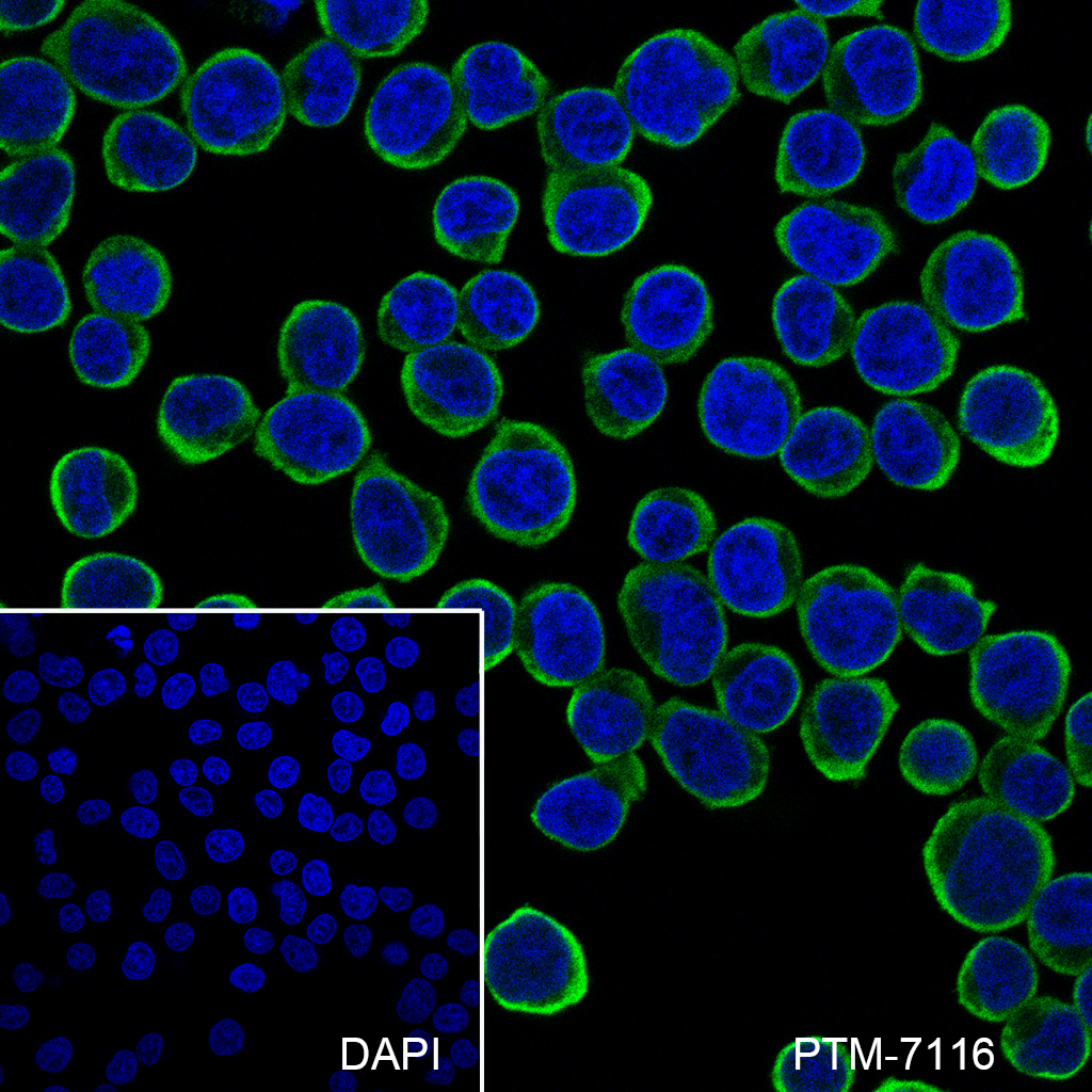 Anti-CD272/BTLA Rabbit mAb