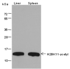 Anti-Acetyl-Histone H2B (Lys11) Mouse mAb
