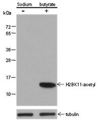 Anti-Acetyl-Histone H2B (Lys11) Mouse mAb