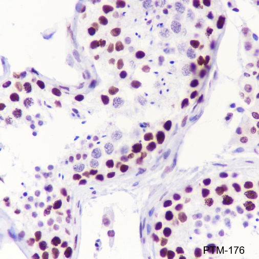 Anti-Acetyl-Histone H2B (Lys11) Mouse mAb