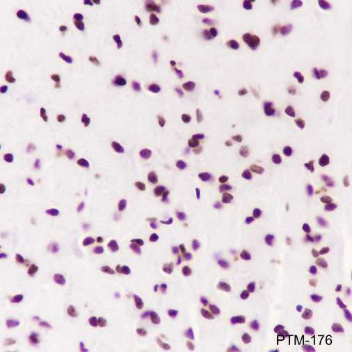 Anti-Acetyl-Histone H2B (Lys11) Mouse mAb