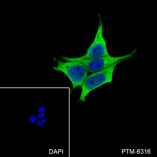 Anti-PDE10A Rabbit mAb