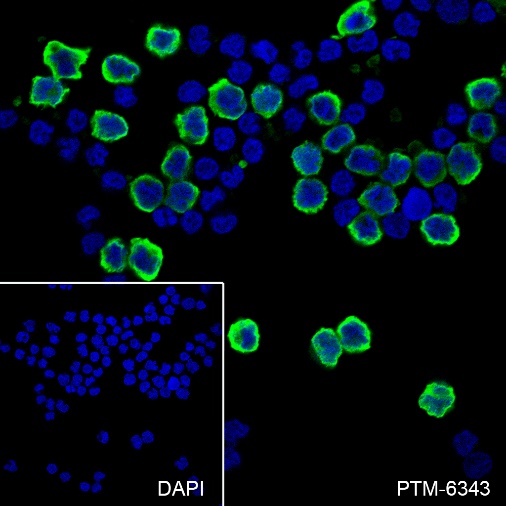 Anti-S100A9 Rabbit mAb