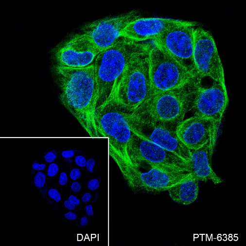 Anti-ELP4 Rabbit mAb