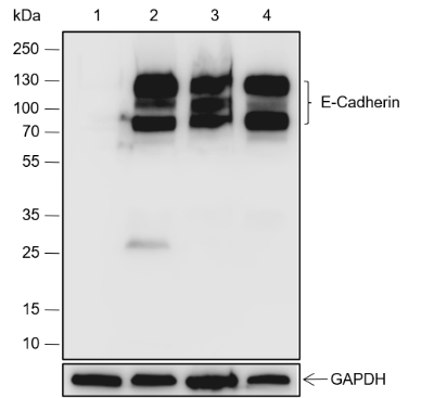 Anti-E-Cadherin Rabbit mAb