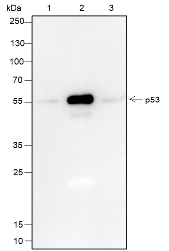 Anti-p53 Rabbit mAb