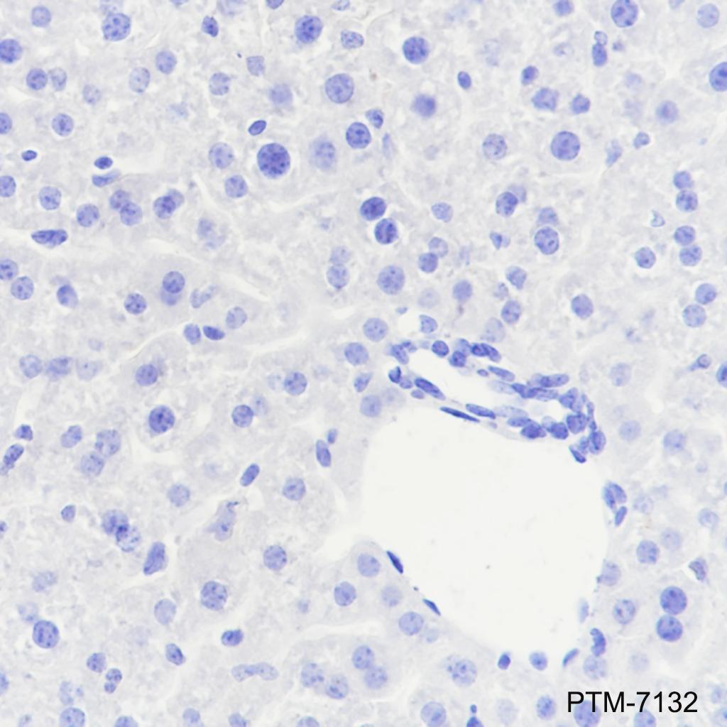 Anti-CD8 beta Rabbit mAb