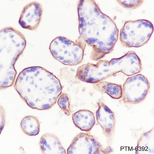 Anti-5T4 Rabbit mAb