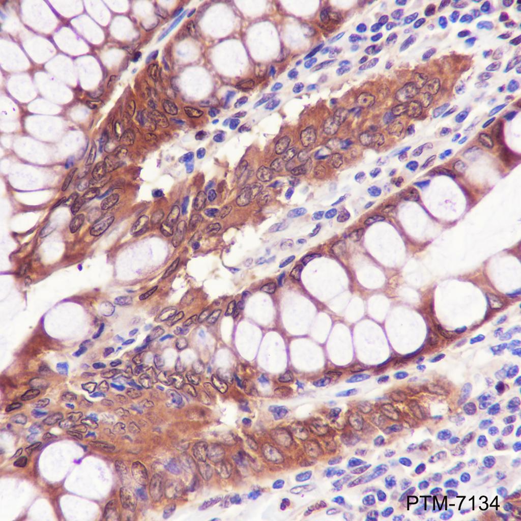 Anti-HSP70 Rabbit mAb