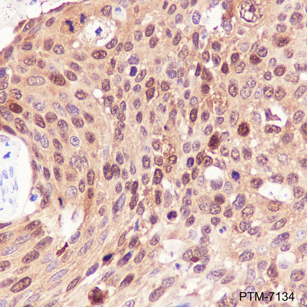 Anti-HSP70 Rabbit mAb