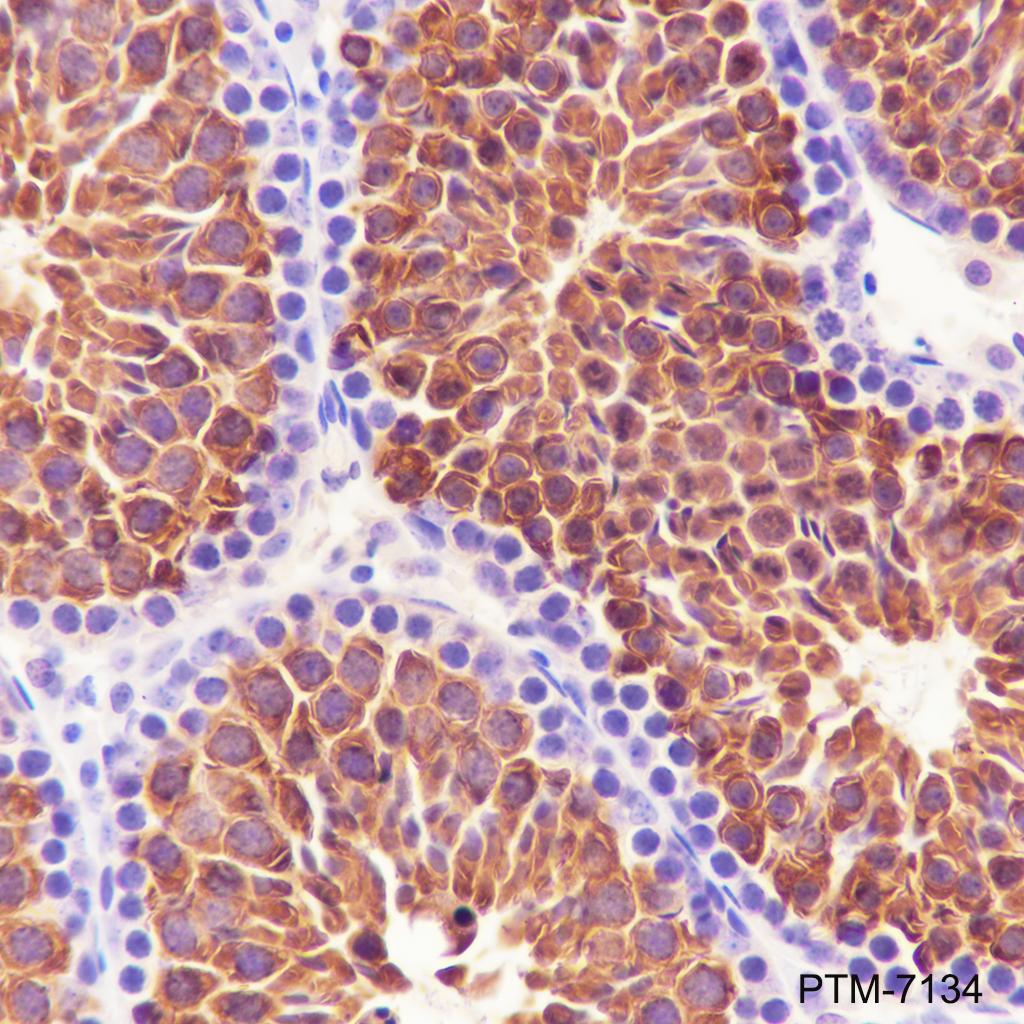 Anti-HSP70 Rabbit mAb