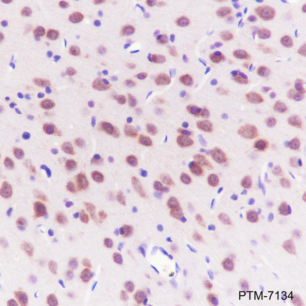 Anti-HSP70 Rabbit mAb
