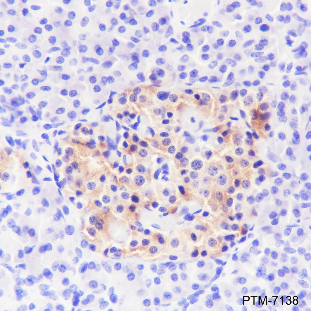 Anti-SV2A Rabbit mAb