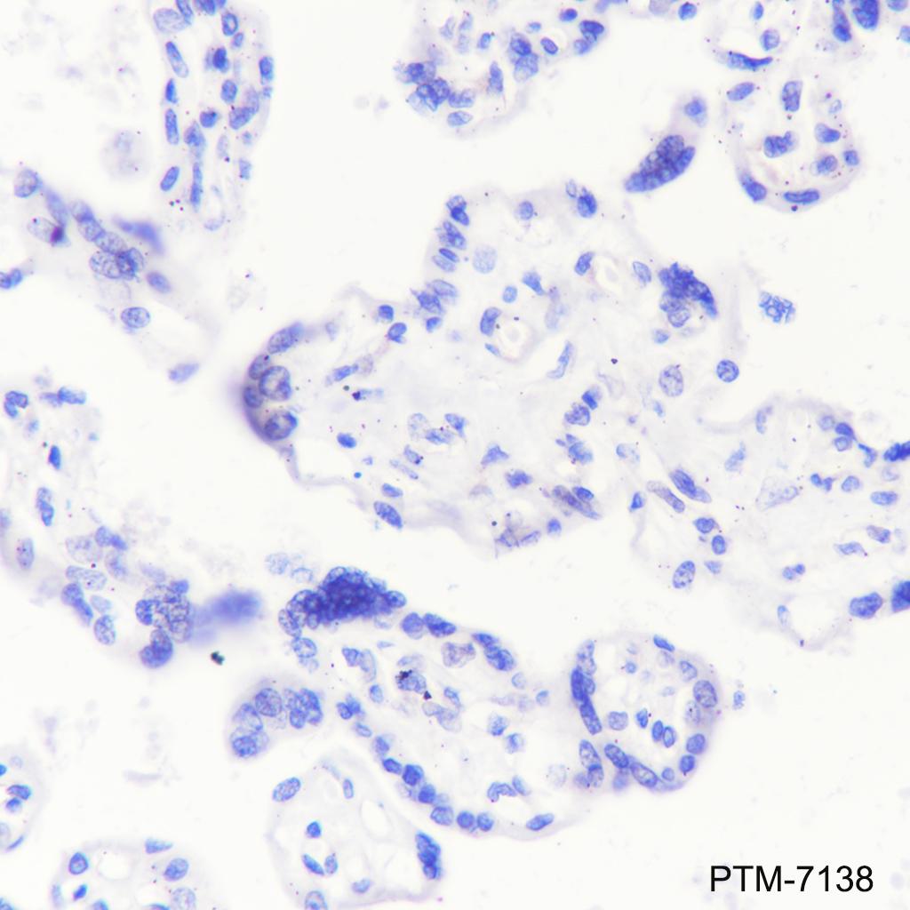 Anti-SV2A Rabbit mAb