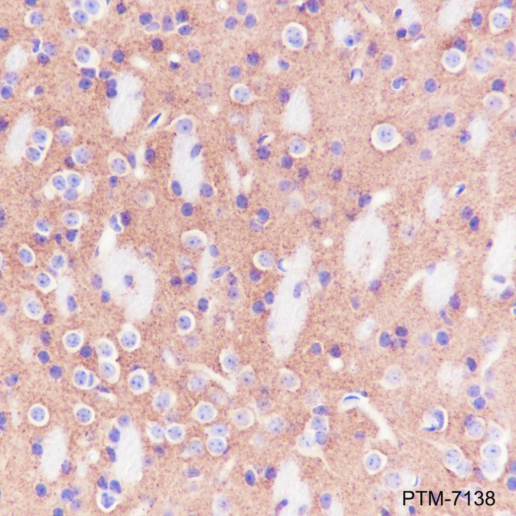 Anti-SV2A Rabbit mAb