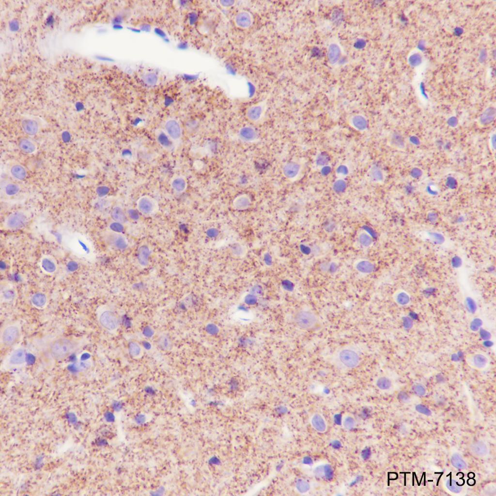Anti-SV2A Rabbit mAb