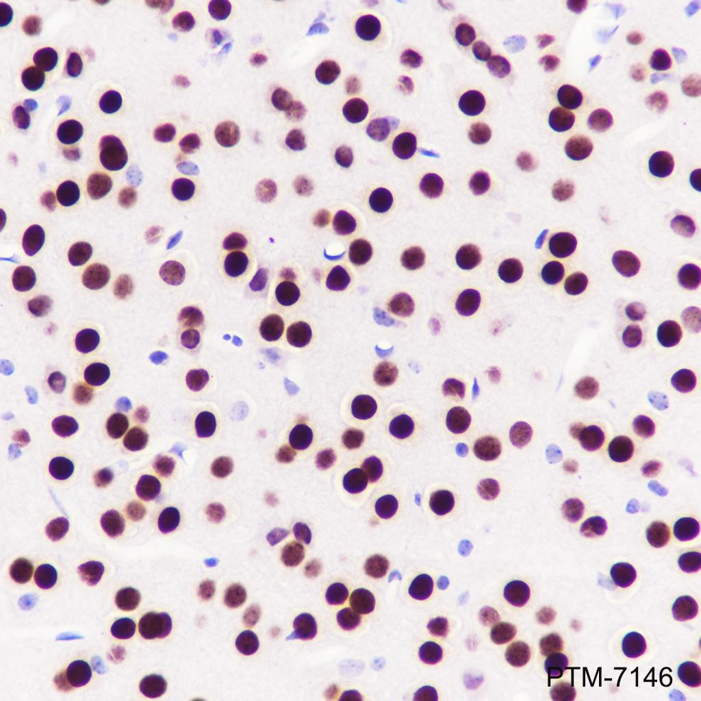 Anti-TBR1 Rabbit mAb